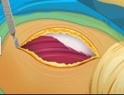 Virtual Hip Replacement